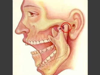 Ortodontik Problemler